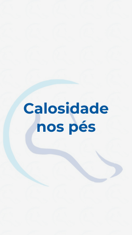 Calosidade nos pés