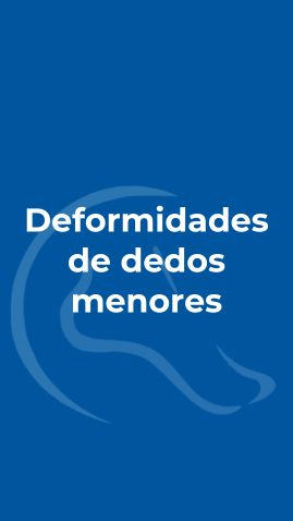 Deformidades de dedos menores