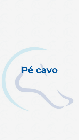 Pé cavo